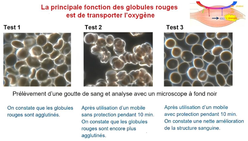 Globules rouges