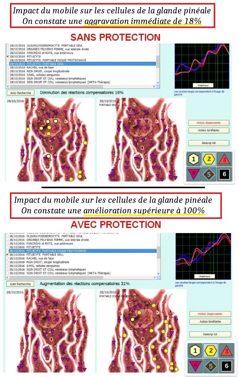 Glande PINEALE test avec et sans protection